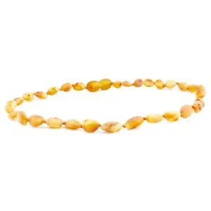 Amber Monkey Baroque 10 Inch Necklace, Raw Honey Pop